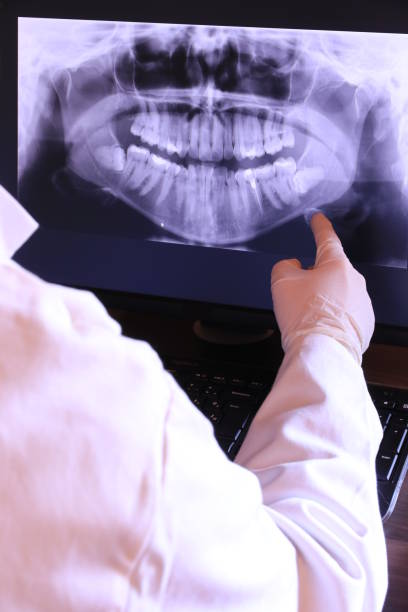 Best Dentist for Tooth Abscess  in Seaside, CA